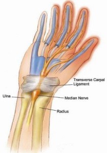 Carpal