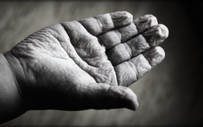 Causes of Hand Pain | Pain in the Hand