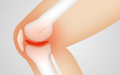 Denosumab: 6 Monthly Injections for the Treatment of Osteoporosis