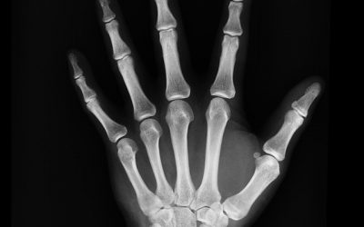 Managing and Diagnosing Musculoskeletal Pain