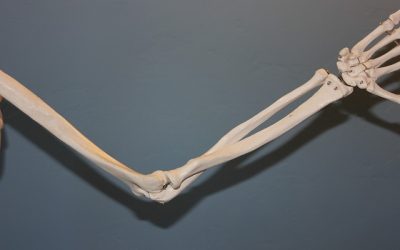 Diagnosing and Treating Tennis Elbow