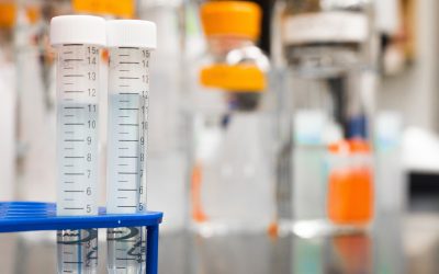 Systemic Lupus Erythematosus Test – All You Need to Know