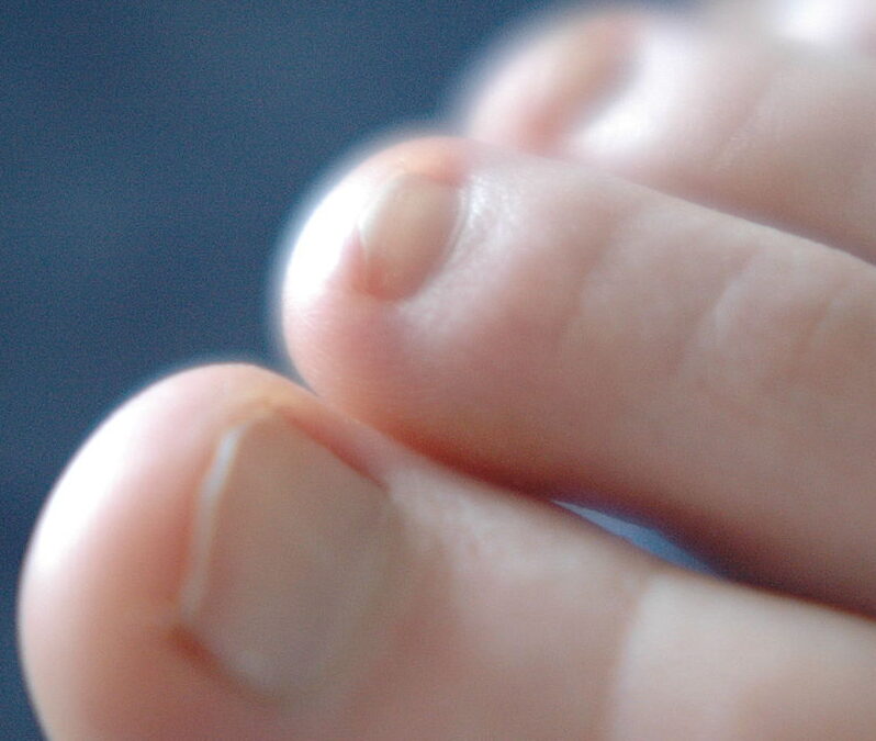 Common Symptoms of Toe Joint Pain